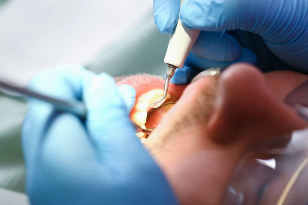 Best Same-Day Emergency Dental Services in Martsville, IN